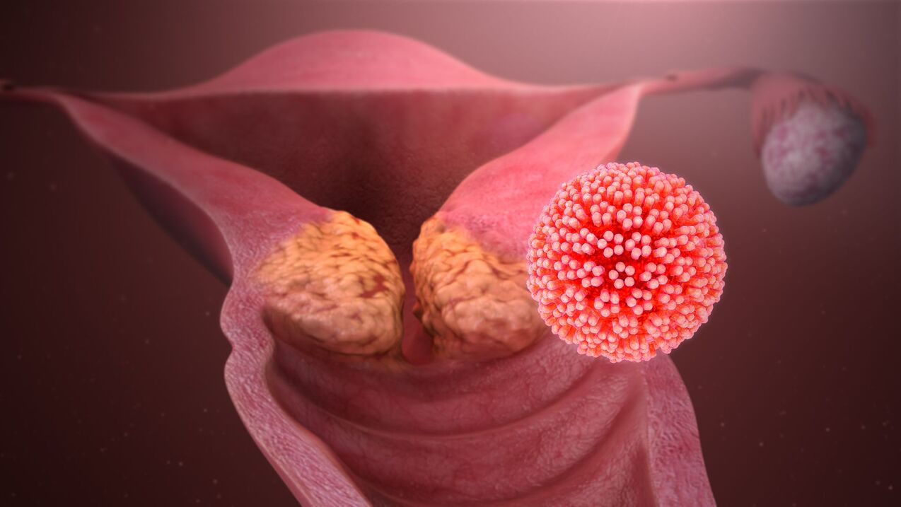 bədəndə insan papillomavirusu
